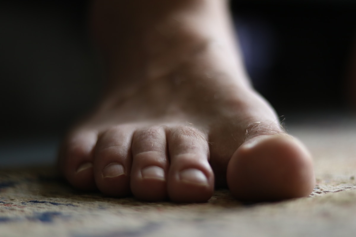 Running with Flat Feet: Socks, Arch Support and What Actually Helps